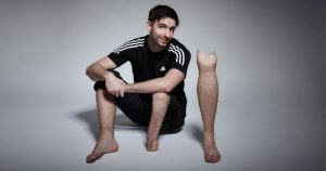 Prótesis funcionales donde se fusiona - Prótesis funcionales donde se fusiona