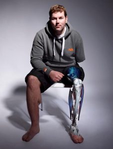 Prótesis funcionales donde se fusiona - Prótesis funcionales donde se fusiona