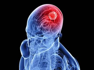 Descubren señal cerebral que enlaza - Descubren señal cerebral que enlaza