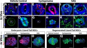 Descubren terapia con capacidad - Descubren terapia con capacidad