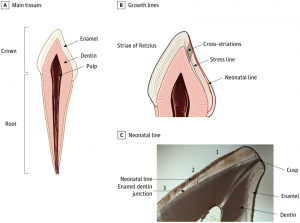Dientes de ‘leche’ contribuyen - Dientes de ‘leche’ contribuyen