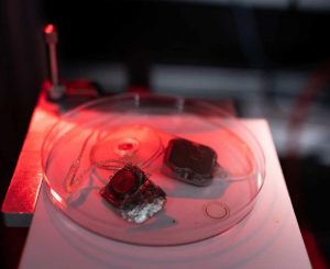 Ojo biónico permite restaurar visión - Ojo biónico permite restaurar visión