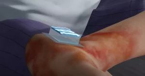 Nanochip posee capacidad de reprogramar células del cuerpo. 1 Nanochip posee capacidad - Nanochip posee capacidad