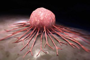 Logran remisión completa - Logran remisión completa