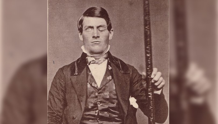 Phineas Gage ¿Cómo sobrevivió a una barra de acero que le atravesó y destruyó el lóbulo frontal?