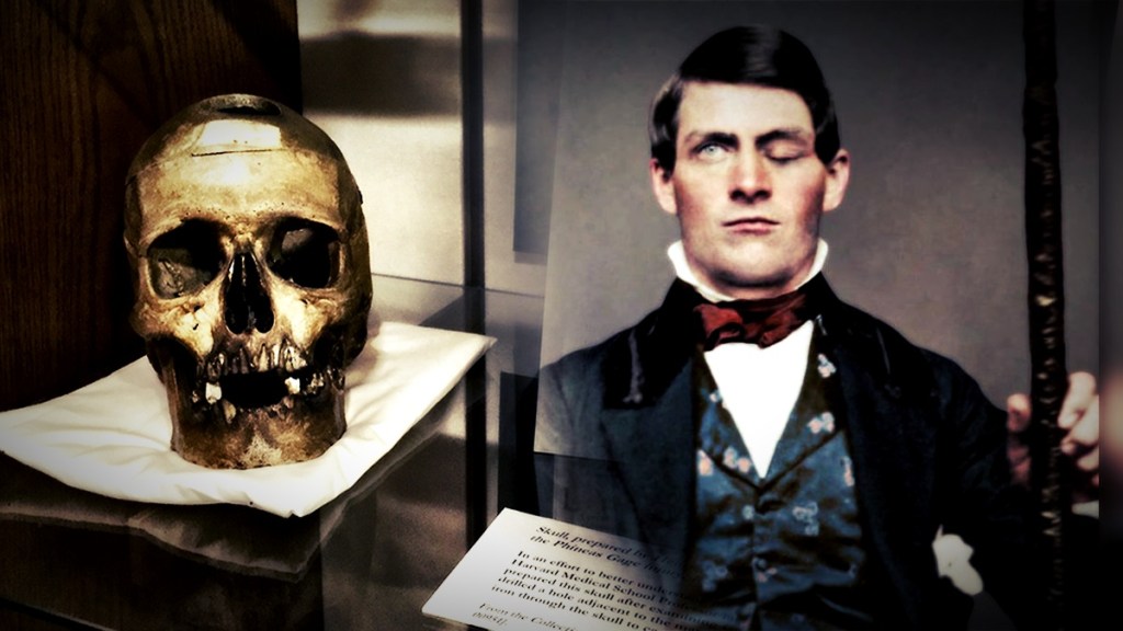 Phineas Gage ¿Cómo sobrevivió a una barra de acero que le atravesó y destruyó el lóbulo frontal?