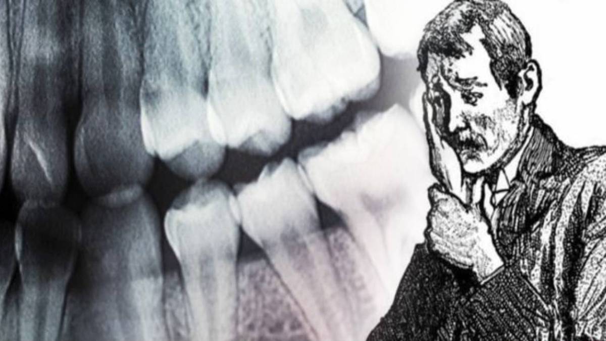 Dientes explosivos: el misterioso caso médico que sigue sin explicación