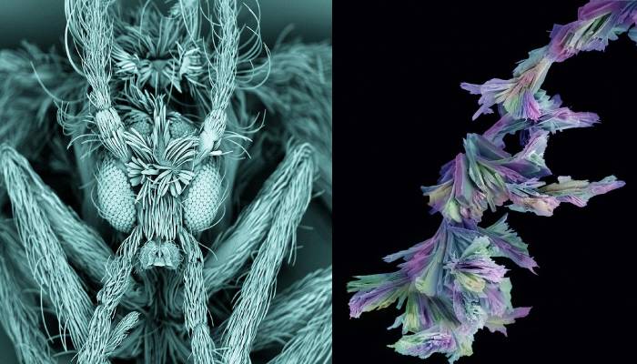 La mejor fotografía de la historia médica