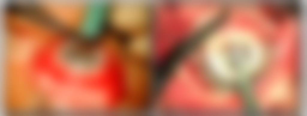 La Queratoprótesis explicada: Un avance en la Cirugía Ocular 5 queratoprótesis - queratoprótesis