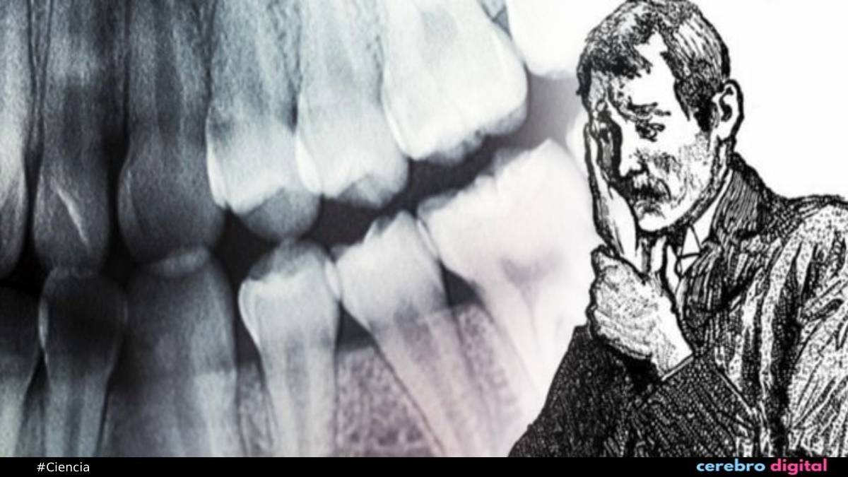 Dientes explosivos: el misterioso caso médico que sigue sin explicación