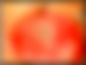 La Queratoprótesis explicada: Un avance en la Cirugía Ocular 6 queratoprótesis - queratoprótesis