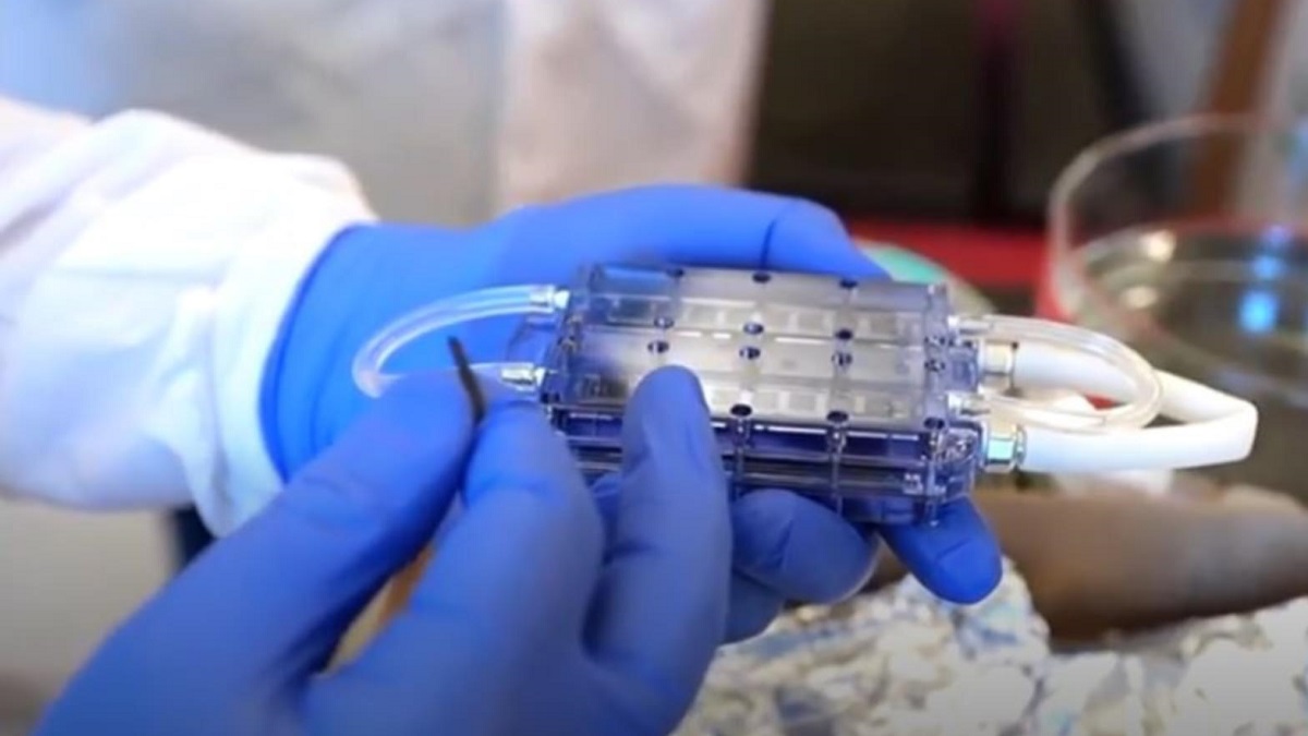 Científicos prueban riñón biónico para pacientes con enfermedad renal 1 -