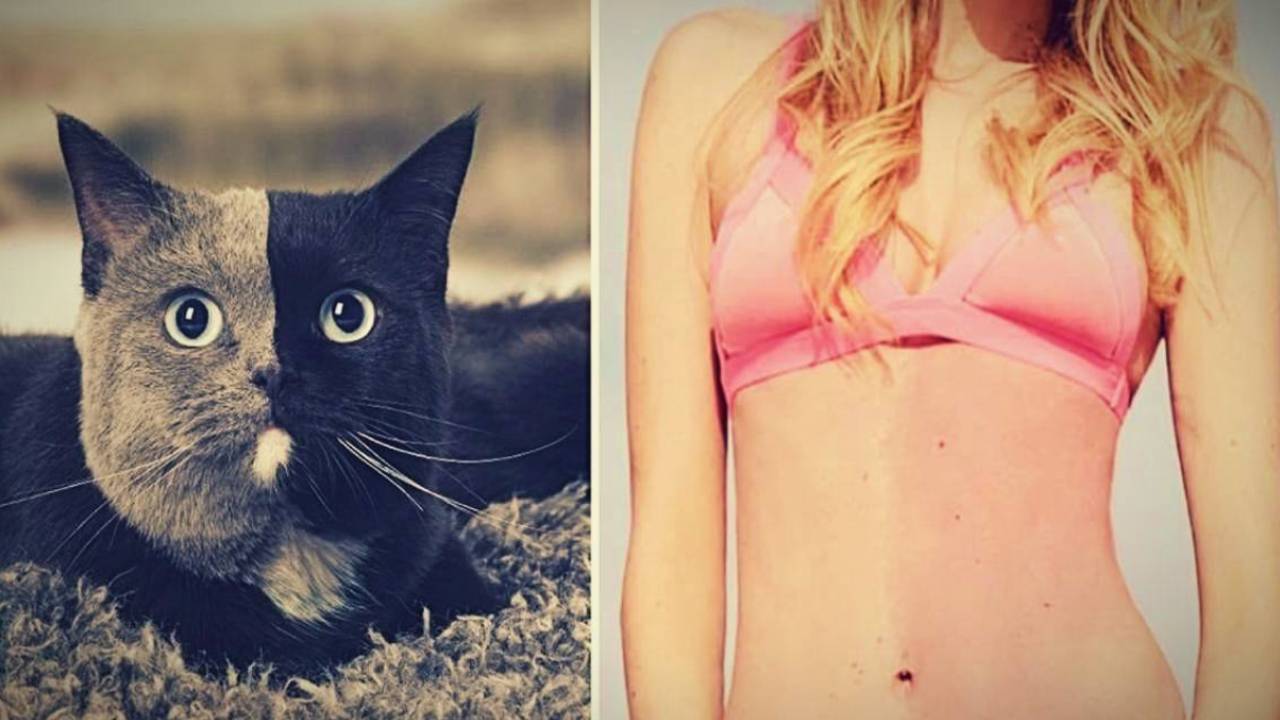 Quimerismo: el extraño caso en el que dos seres habitan el mismo cuerpo