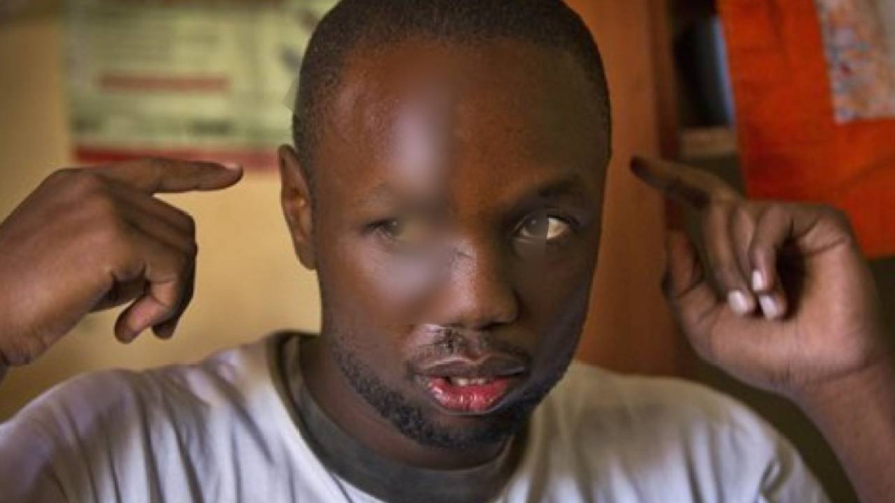 Anthony Omari: el superhéroe de la cicatriz