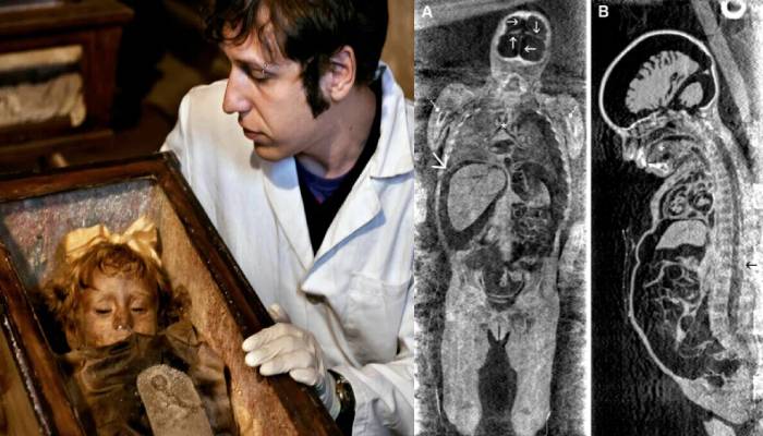 Rosalía Lombardo: La momia más hermosa del mundo