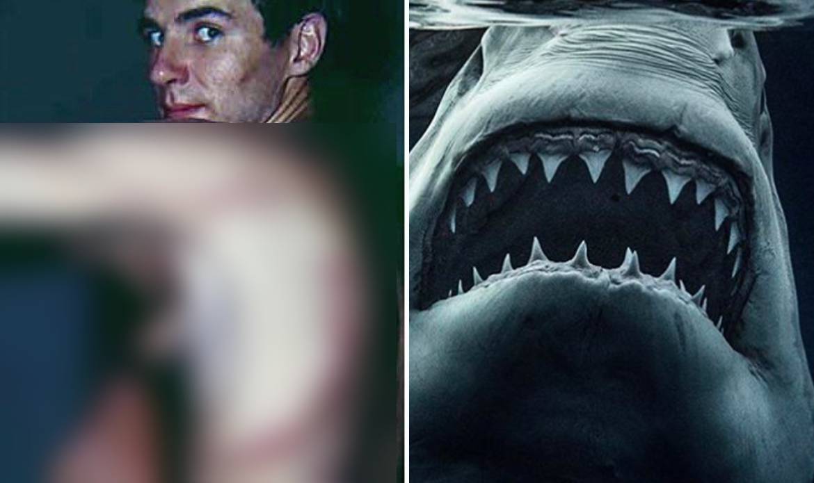 Rodney Fox: el hombre que sobrevivió al ataque de un tiburón blanco