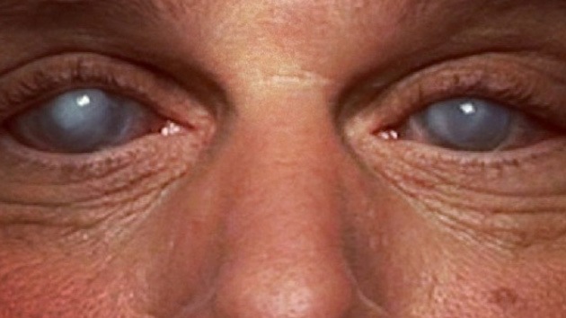 Síndrome de Charles Bonnet: visiones más allá de la realidad