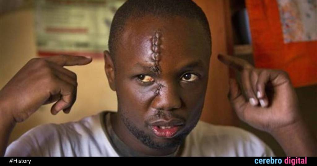 Anthony Omari: The Scarred Superhero