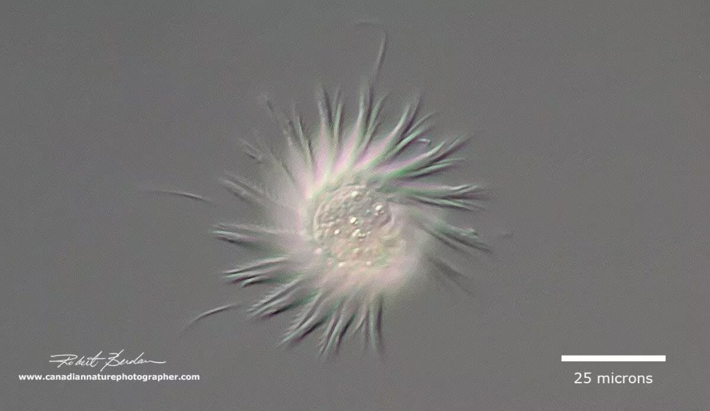 Descubren un organismo que se alimenta de virus