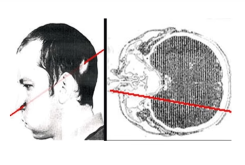 El hombre que metió su cabeza dentro de un acelerador de partículas mientras estaba encendido 2 -