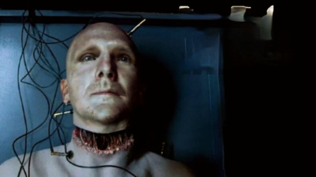 ¿Qué pasó con el “trasplante de cabeza”? Entre la locura y la ciencia