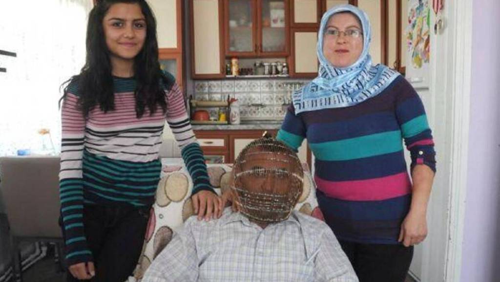Encerró su cabeza en una jaula para dejar de fumar