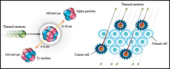 Japón es pionero en un nuevo tratamiento de radiación contra el cáncer