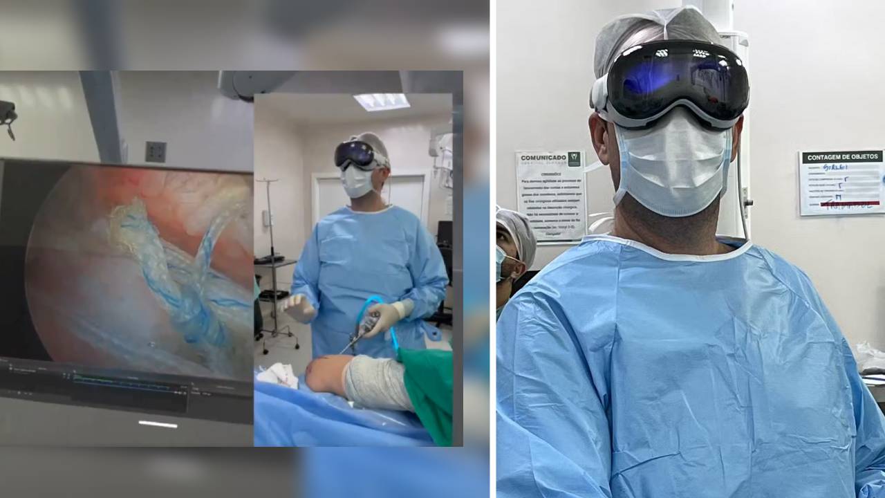 Apple Vision Pro es usada exitosamente durante una cirugía de artroscopia de hombro en Brasil