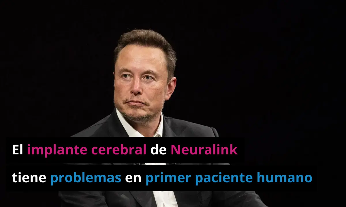 Implante cerebral de Neuralink tiene problemas en primer paciente humano (1)