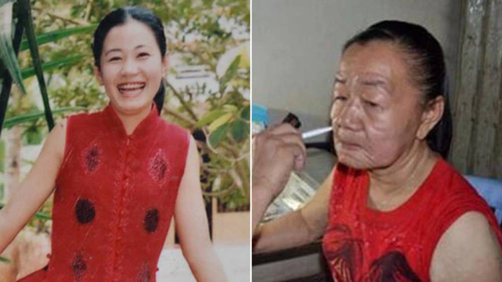 Nguyen Thi Phuong: El extraño caso de envejecimiento acelerado