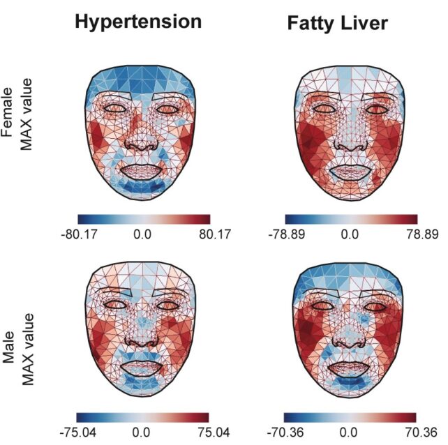 Patrones de calor de tú rostro podrían dar pistas sobre tú salud