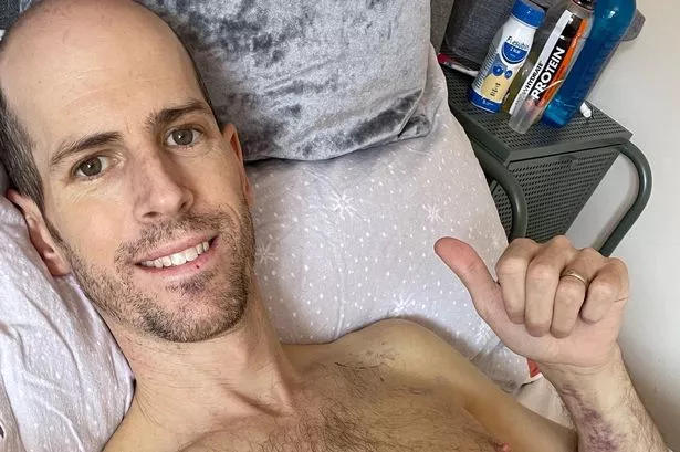 Trasplante de hígado: el increíble cambio de un hombre después de recibir uno