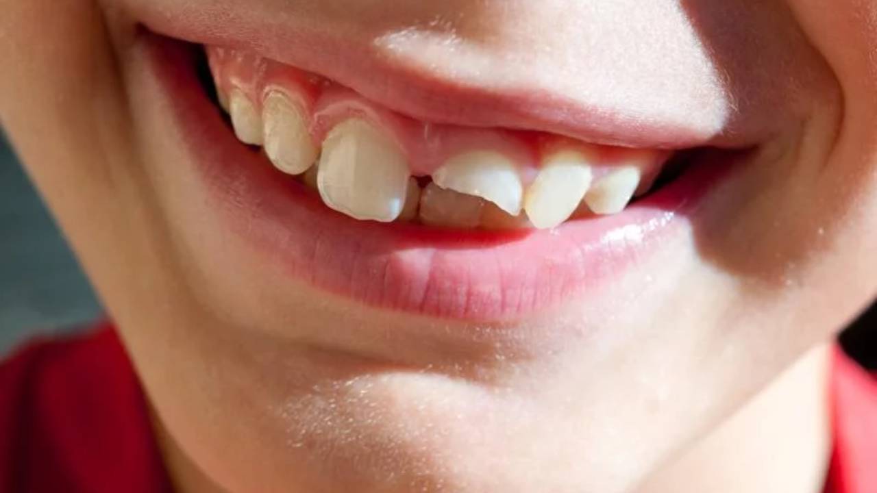 Un nuevo tratamiento podría regenerar los dientes al crear “empastes vivos”