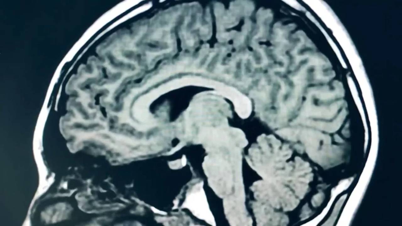 Podrían haber identificado un extraño factor impulsor de la COVID prolongada