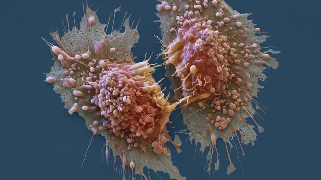 Un nuevo fármaco contra el cáncer de mama elimina tumores en ratones en una sola dosis