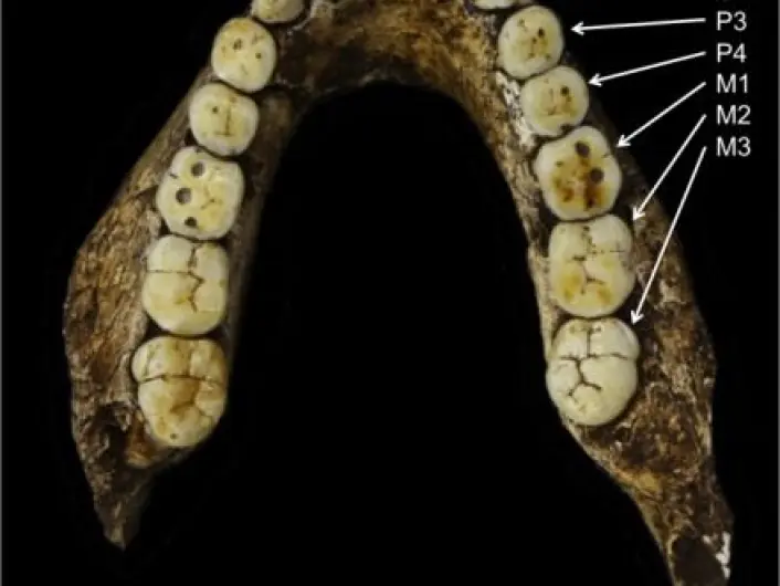 Los humanos están evolucionando para perder dientes