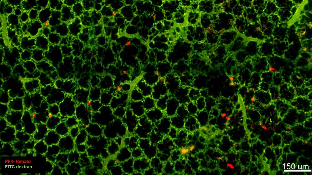 Los pulmones demuestran tener otra sorprendente función: producir sangre 1 Los pulmones demuestran tener otra sorprendente función: producir sangre