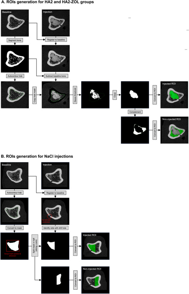 Inyecciones de hidrogel aumentan rápidamente la densidad ósea