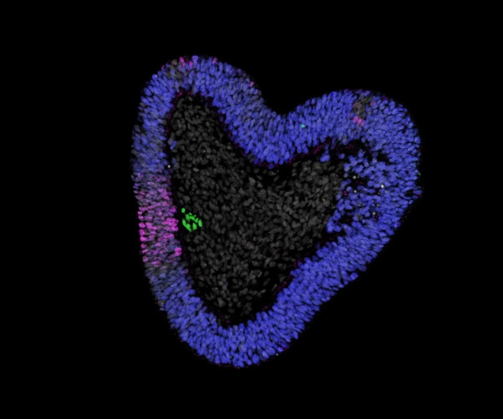 columna,vertebral - columna