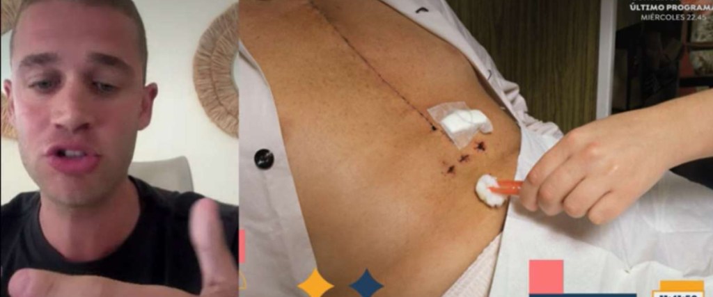 Morderse las uñas casi le cuesta la vida  a un influencer peruano