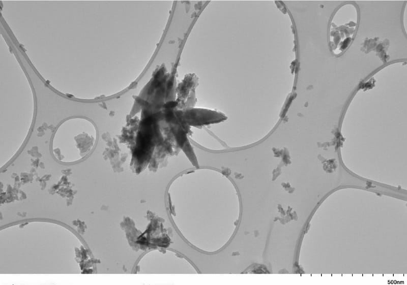 Encuentran microplásticos en las arterias de sobrevivientes de ACV