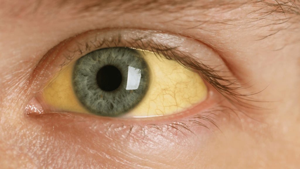 suplementos - suplementos