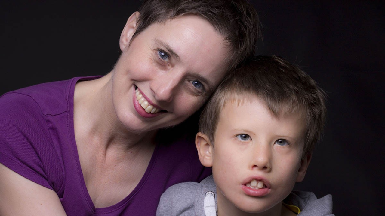 Síndrome de Moebius