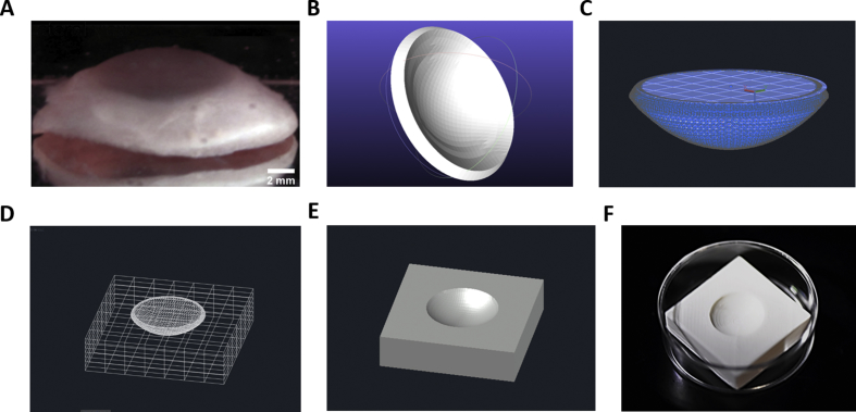 Primeras córneas humanas impresas en 3D: un avance que podría cambiar la medicina ocular 2 Primeras córneas humanas impresas en 3D: un avance que podría cambiar la medicina ocular
Un equipo de científicos de la Universidad de Newcastle ha logrado un hito en la medicina regenerativa: imprimir en 3D las primeras córneas humanas funcionales utilizando biotinta compuesta por células madre y materiales biocompatibles. Este avance podría representar una solución real a la escasez global de córneas disponibles para trasplantes, ofreciendo esperanza a millones de personas con riesgo de ceguera.
Una biotinta innovadora para imprimir córneas humanas
La córnea, la capa externa del ojo humano, es esencial para enfocar la luz y mantener una visión nítida. Sin embargo, sufre una enorme demanda médica: más de 10 millones de personas en todo el mundo necesitan cirugía corneal para prevenir la pérdida total de visión, mientras que aproximadamente 5 millones ya viven con ceguera debido a cicatrices corneales provocadas por traumatismos, quemaduras o enfermedades infecciosas como el tracoma.
Ante esta realidad, los investigadores desarrollaron una "biotinta" compuesta por una mezcla de alginato y colágeno con células madre del estroma corneal humano. Esta tinta permitió imprimir, con una impresora 3D sencilla y económica, córneas en menos de 10 minutos. Lo más notable es que las células madre sobrevivieron al proceso de impresión y continuaron creciendo, demostrando que la estructura creada no solo es viable, sino funcional.
Che Connon, profesor de Ingeniería de Tejidos y líder del proyecto, explicó que este logro se basa en estudios previos que permitieron mantener células vivas durante semanas en condiciones no refrigeradas. La fórmula del gel es suficientemente rígida como para mantener la forma de la córnea, pero también lo bastante flexible para ser expulsada por la boquilla de la impresora sin dañar las células.
Lo revolucionario no es solo la rapidez o la sencillez del procedimiento, sino su capacidad para personalizar cada córnea impresa según las necesidades específicas del paciente. A través del escaneo del ojo del receptor, los científicos pueden reproducir digitalmente una córnea a medida, optimizando tanto el ajuste como la función visual.
Esperanza médica y una solución al déficit de donantes
La técnica no solo ofrece una alternativa futurista, sino que responde a una necesidad urgente: la insuficiencia de tejidos disponibles para trasplantes. Actualmente, miles de pacientes permanecen en lista de espera debido a la escasez de donantes de córneas, situación agravada en muchos países por factores culturales o falta de infraestructura médica adecuada.
Abigail Isaacson, primera autora del estudio y miembro del Instituto de Medicina Genética de la Universidad de Newcastle, participó en la validación del proceso y en la obtención de las dimensiones ideales para las córneas impresas. Gracias al escaneo tridimensional del ojo humano, cada estructura puede replicarse con exactitud milimétrica, lo que reduce el riesgo de complicaciones postoperatorias y aumenta la eficacia del trasplante.
El trabajo fue publicado en Experimental Eye Research, y aunque pasarán varios años antes de que las córneas impresas estén disponibles clínicamente, los científicos destacan que ya han superado la barrera más compleja: demostrar que es posible crear un tejido ocular viable, personalizado y escalable a partir de células humanas.
Neil Ebenezer, director de investigación de la organización Fight for Sight, elogió el avance como un paso crucial para reducir la dependencia de donaciones y dar acceso a tratamientos a más personas, especialmente en regiones del mundo con baja tasa de donantes. No obstante, subrayó que, hasta que la técnica esté disponible de forma masiva, es vital seguir fomentando la donación de tejidos oculares.
El próximo paso consistirá en someter las córneas impresas a rigurosas pruebas de seguridad, durabilidad y eficacia, tanto en laboratorio como en ensayos clínicos. Solo así podrá determinarse su viabilidad a largo plazo y su uso en hospitales. Pero con los resultados actuales, el horizonte de una oftalmología regenerativa y sin listas de espera parece cada vez más cercano.
Con esta innovación, la Universidad de Newcastle no solo ha dado un paso adelante en bioimpresión, sino que ha abierto la puerta a una revolución en la forma en que tratamos la pérdida de visión. Si los próximos ensayos tienen éxito, en unos años podríamos ver cómo la impresora 3D se convierte en una herramienta indispensable en las salas de cirugía ocular.
Referencia:
Experimental Eye Research/3D Bioprinting of a Corneal Stroma Equivalent. Link