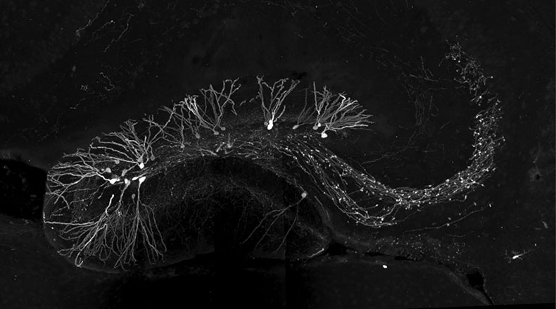 ejercicio - ejercicio