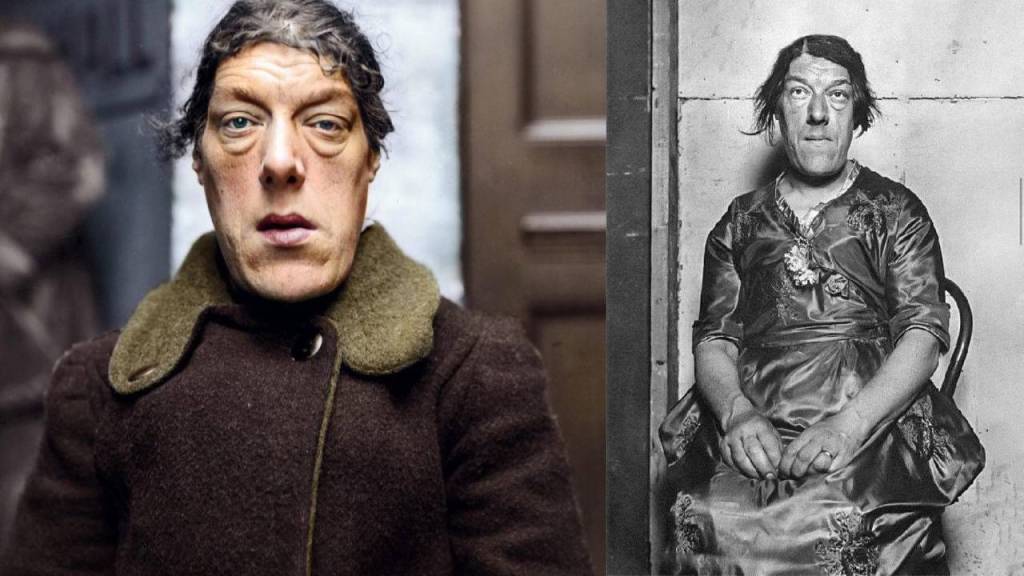 Mary Ann Bevan: The Woman Who Endured Being Called the Ugliest in the World for Her Children