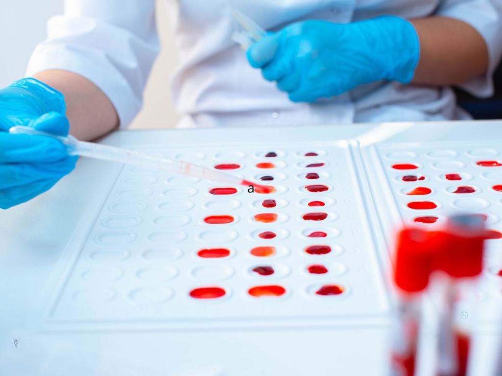 Descubren un nuevo tipo de sangre: solo una persona en el mundo lo posee