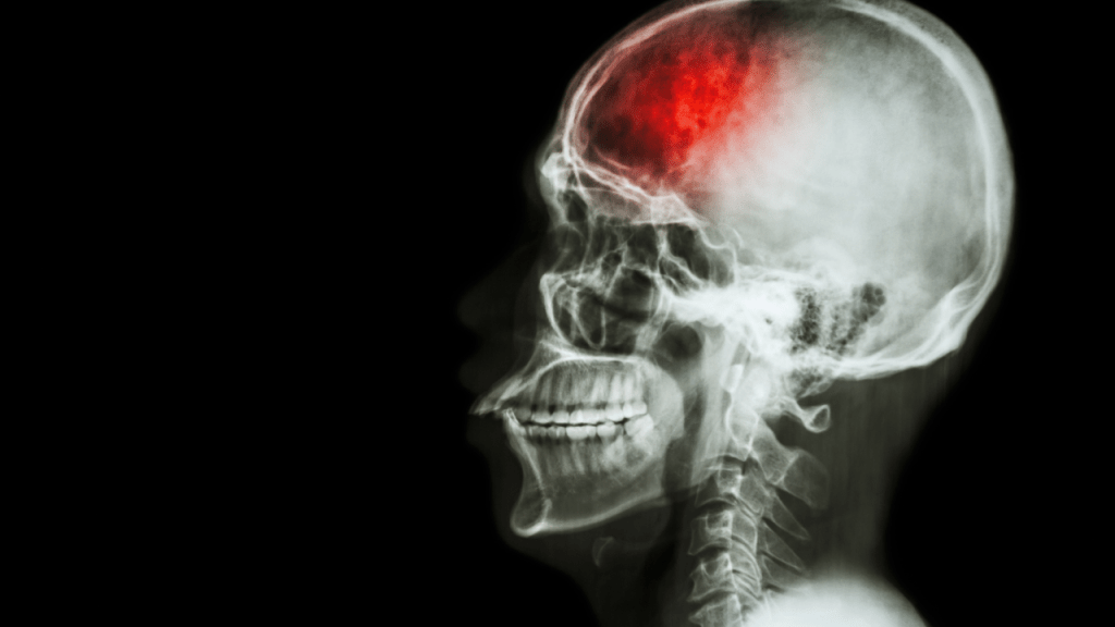 Eritritol - Eritritol