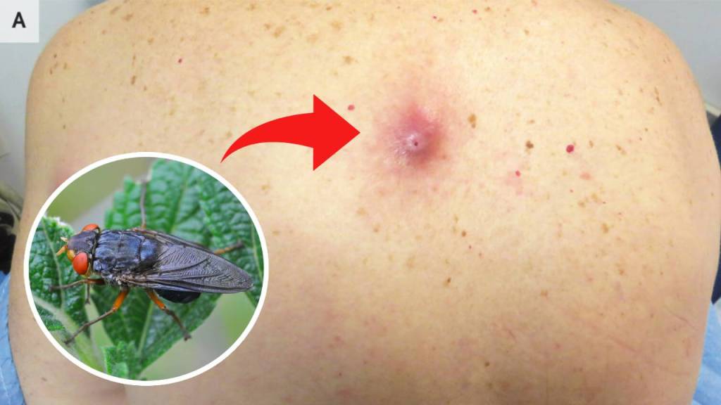 La Mosca Raspberry Dermatobia hominis: la mosca parásita que literalmente se mete bajo tu piel