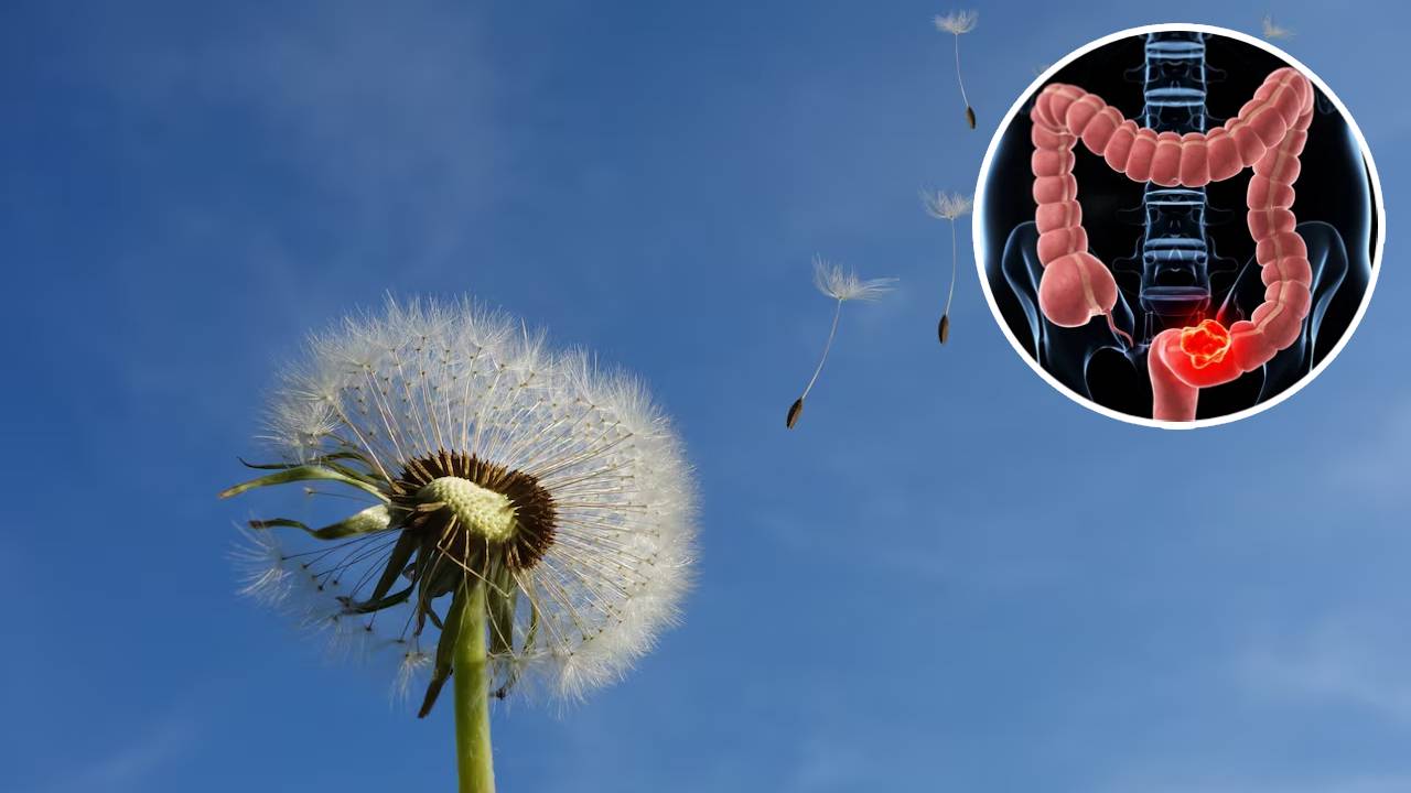 Extracto de raíz de diente de león pudo detener el cáncer de colon en laboratorio